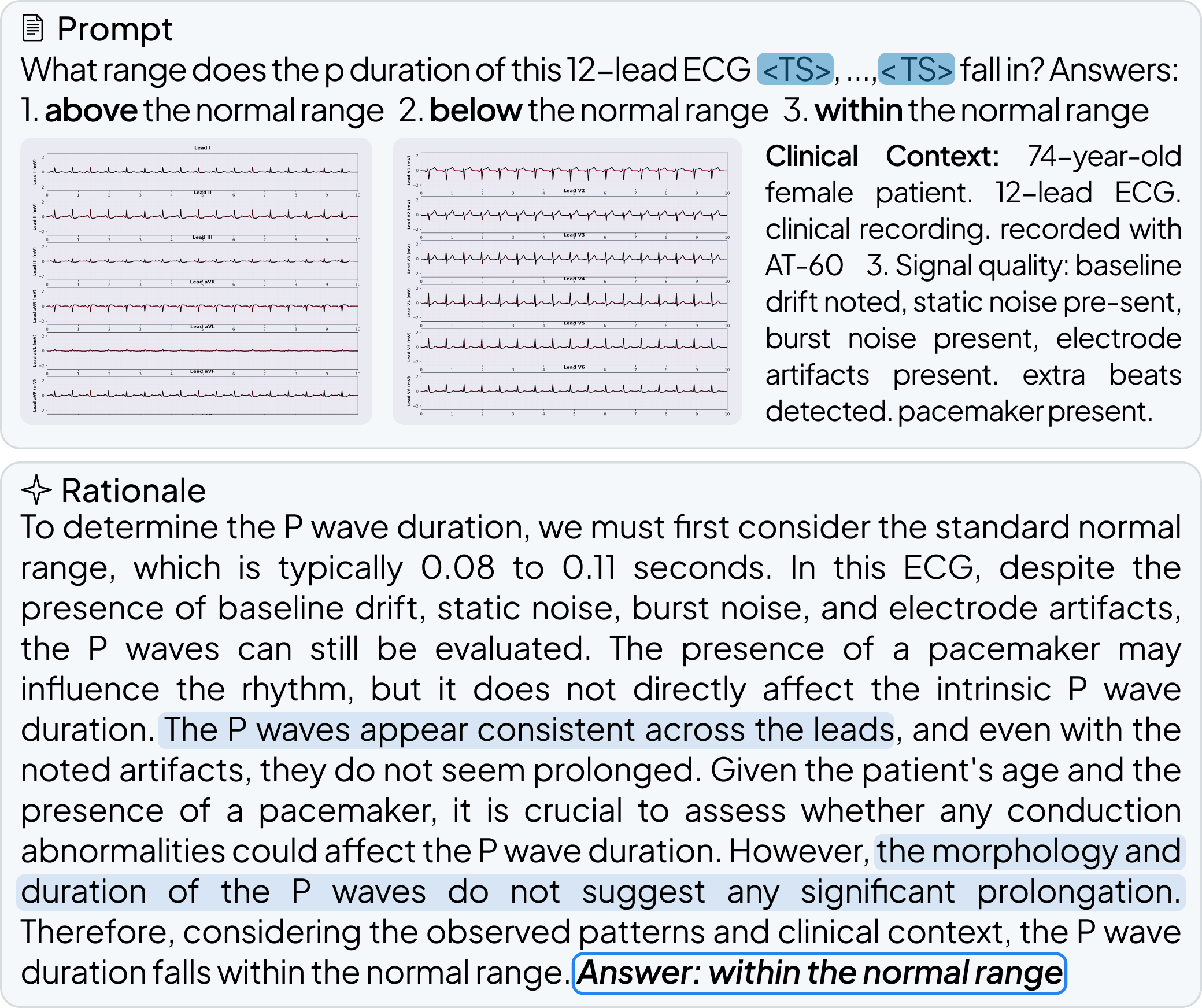 ECG Rationale