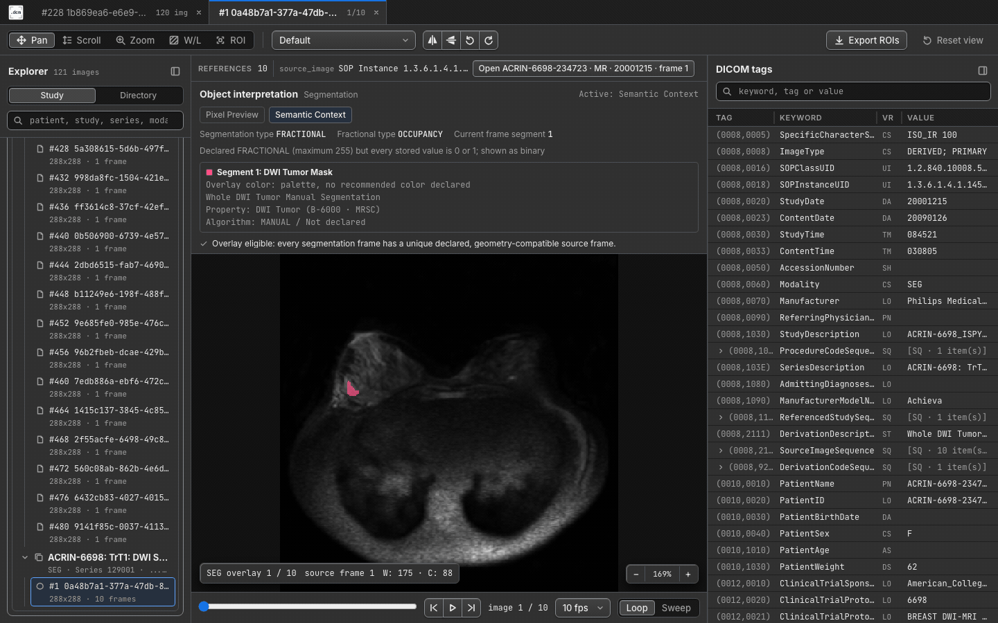 DICOM SEG semantic overlay in dcmview
