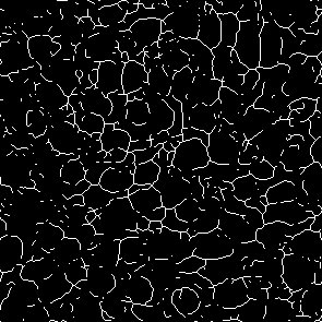 Skeleton — midlines