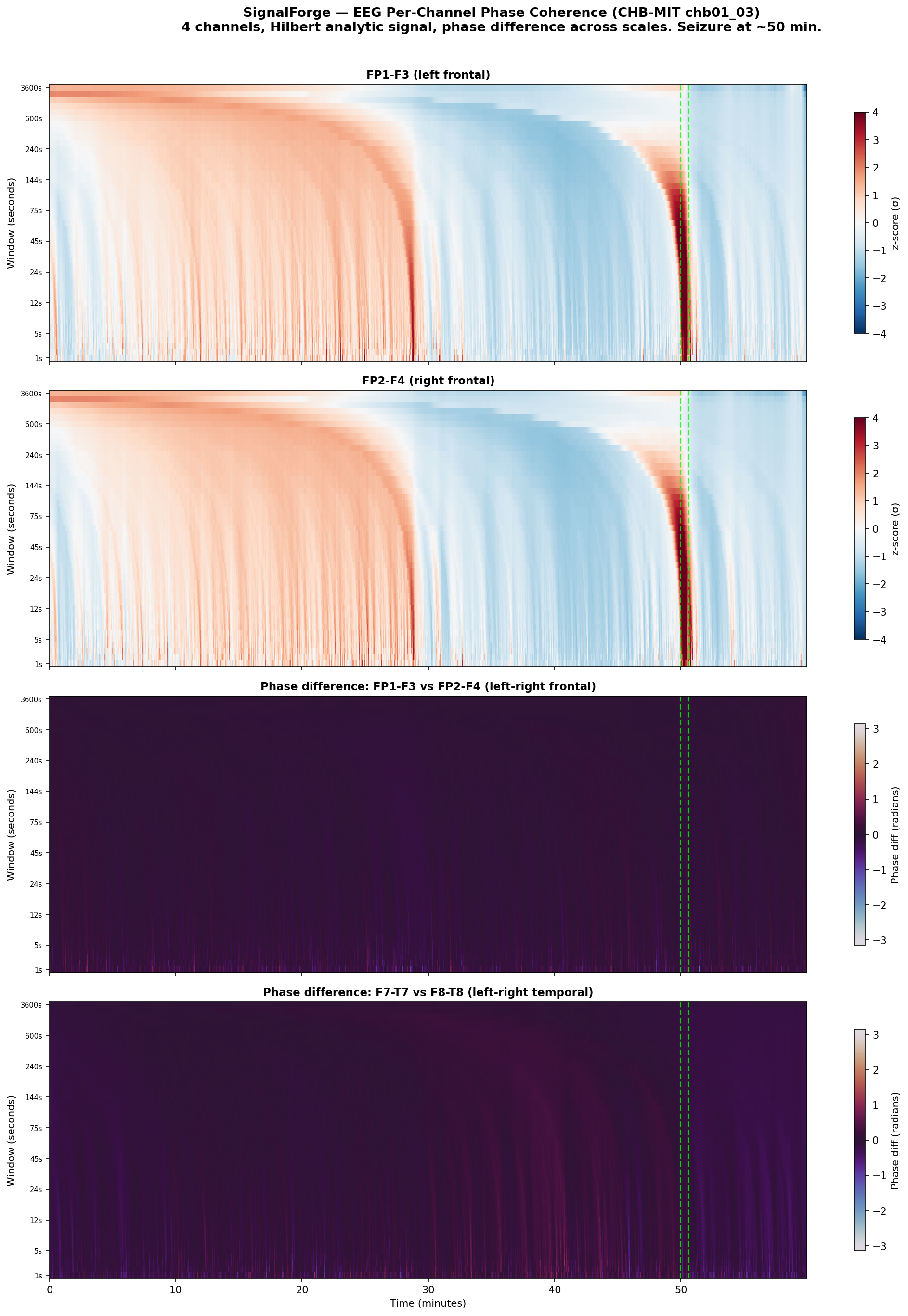 EEG phase coherence
