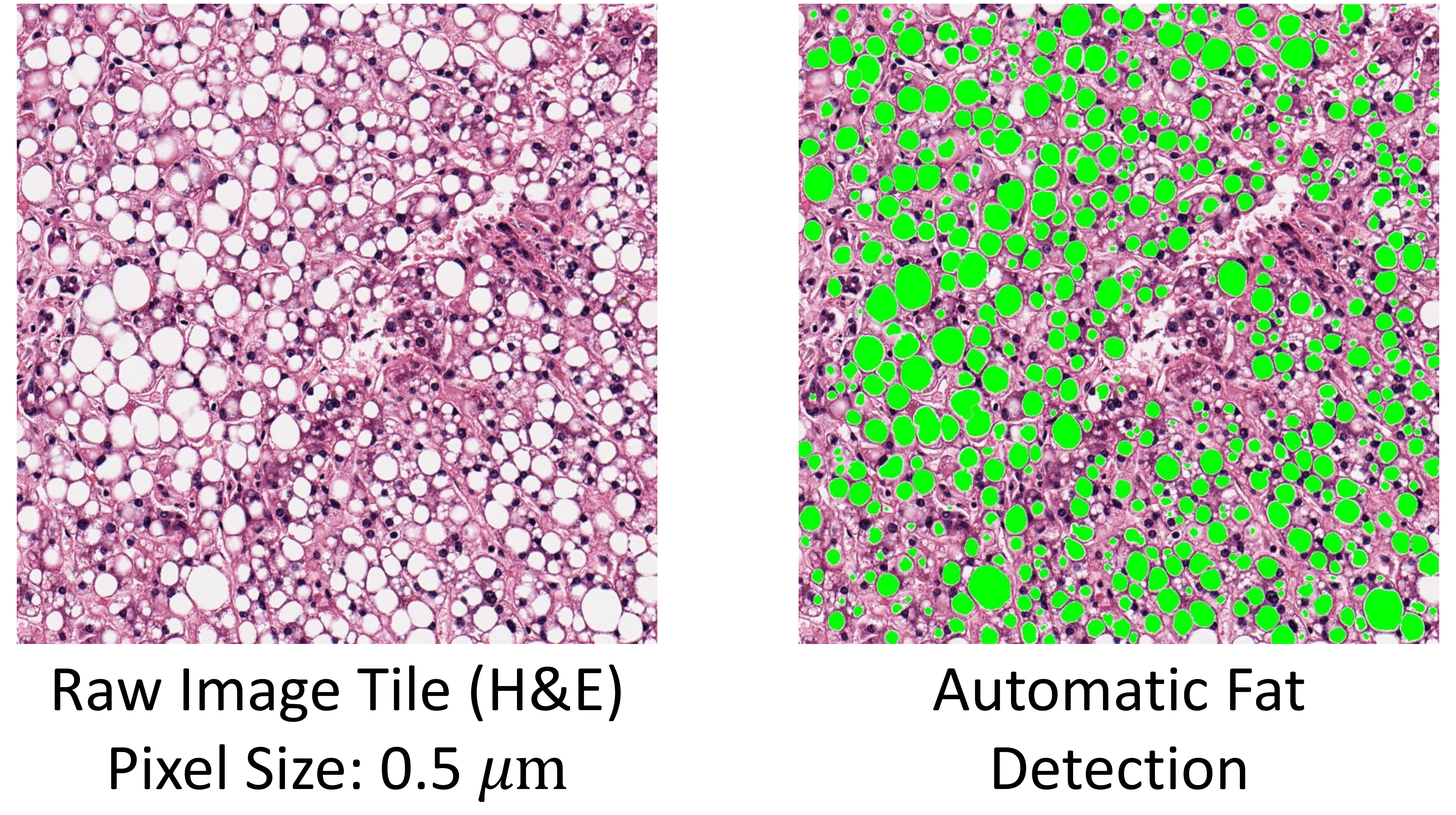 Fat Detection Example