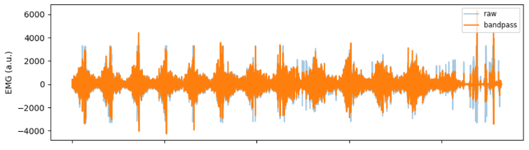 Raw vs Filtered Signal