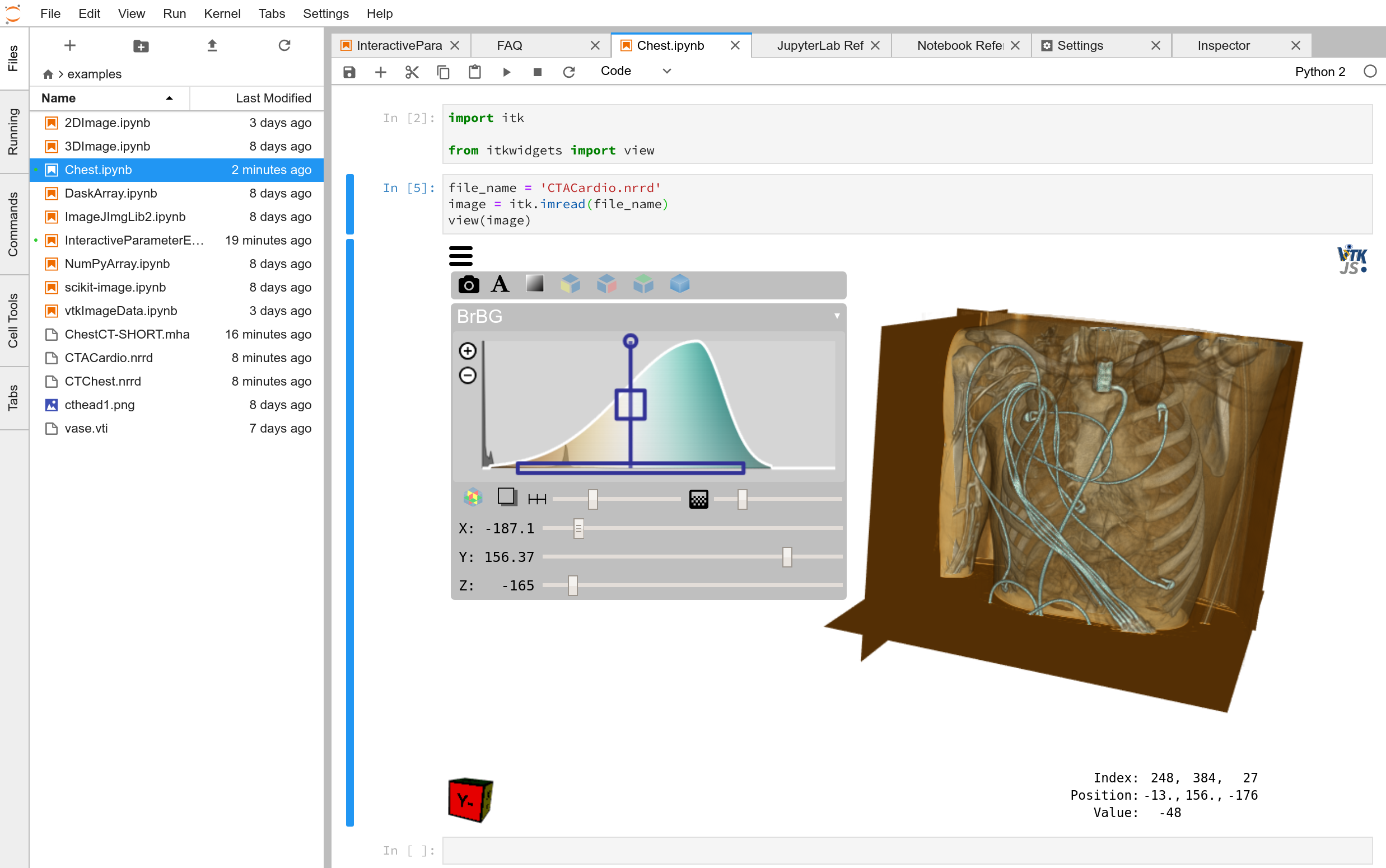 itk-jupyter-widgets chest CT in JupyterLab