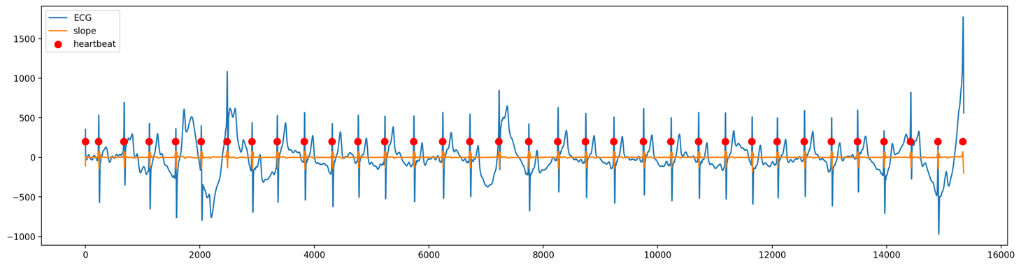 ECG heartbeat calculation slow