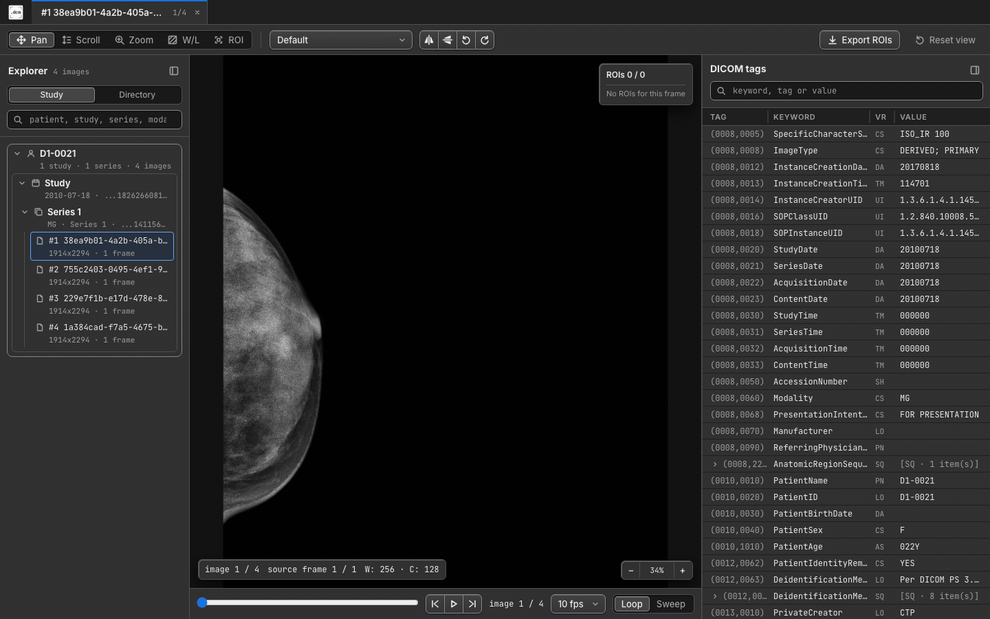 Mammography study in dcmview