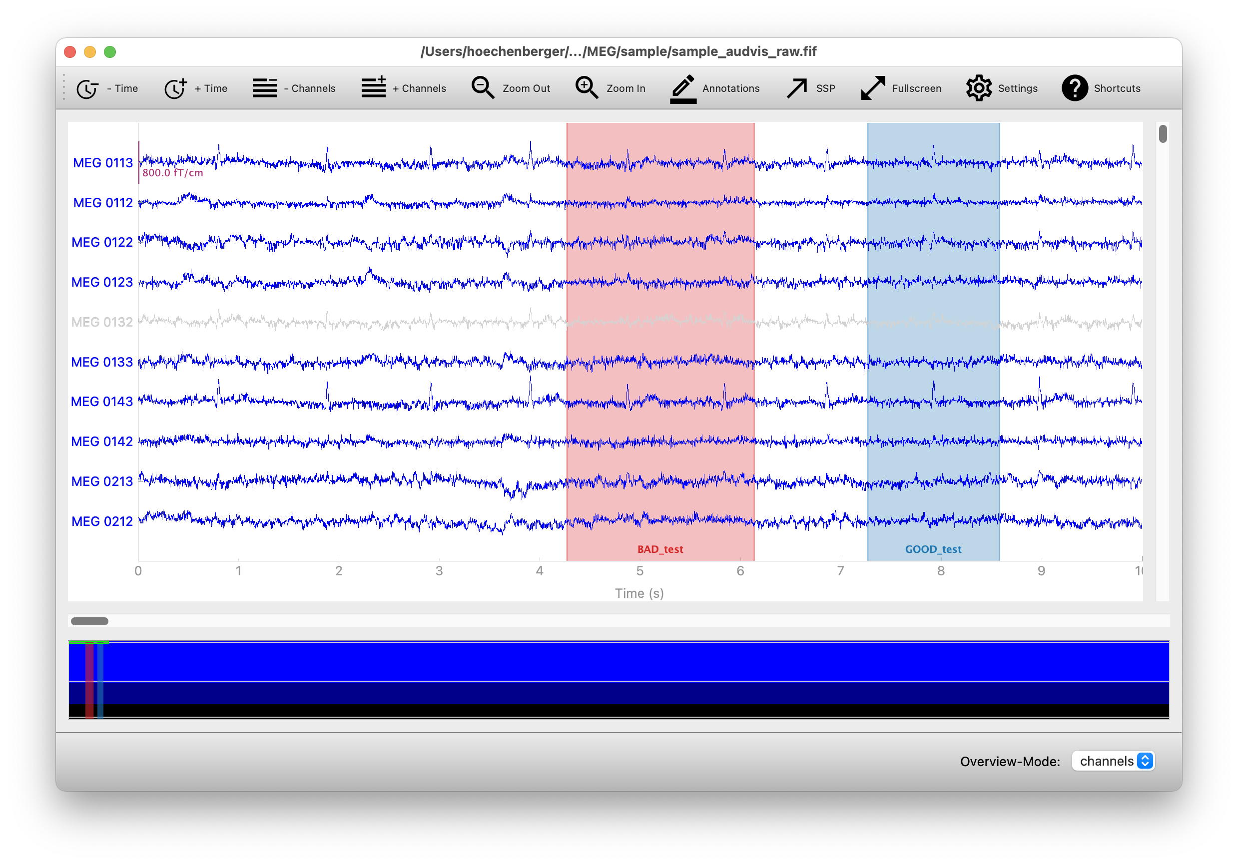 Screenshot of mne-qt-browser