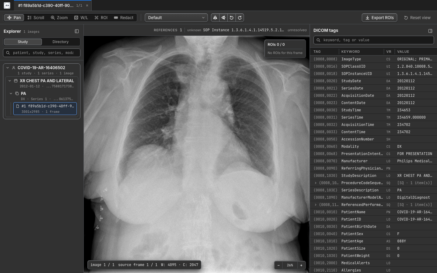 Chest radiograph in dcmview