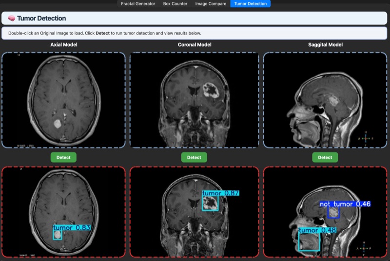 Tumor Detection