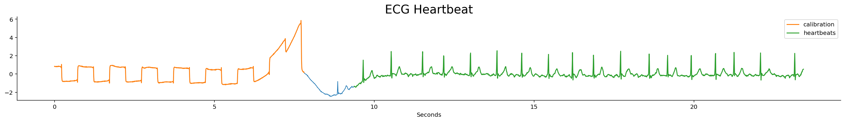 The ECG heartbeat dataset