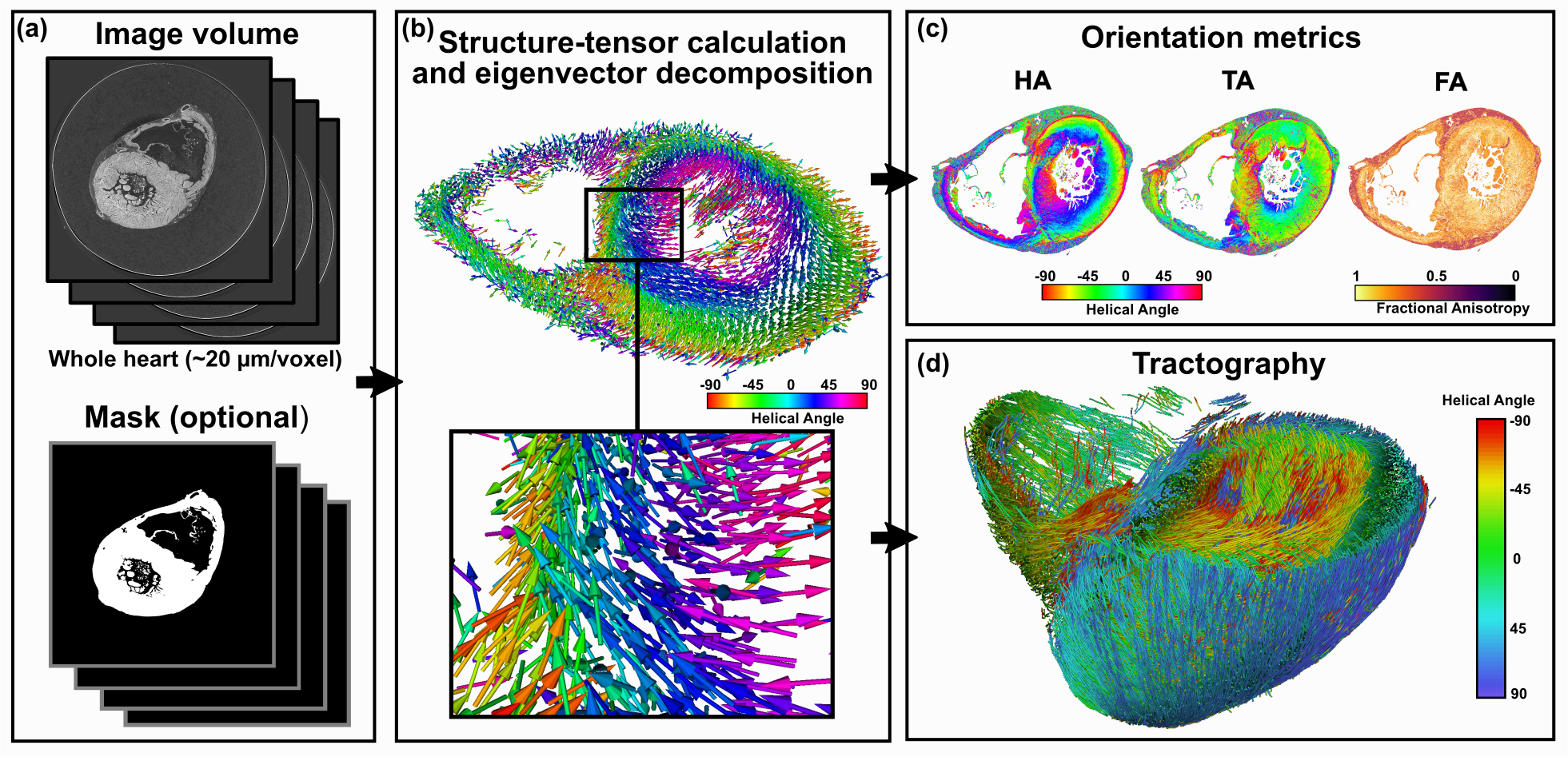 Cardiotensor pipeline for 3D cardiac orientation analysis