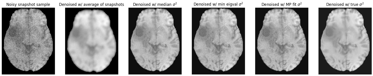 MRI denoising with MP-PCA