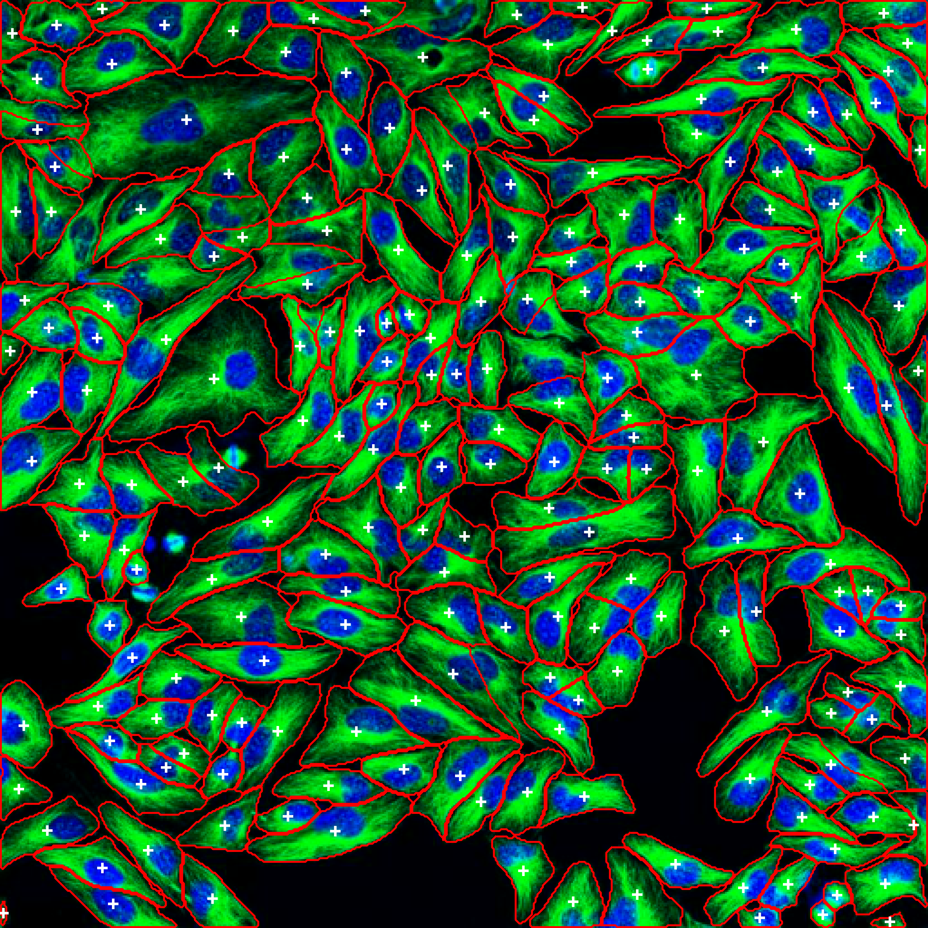 Segmented cells with annotations