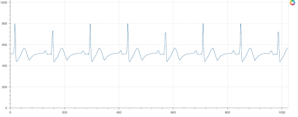https://github.com/logston/olimex-ekg-emg/raw/master/docs/images/nsr.gif