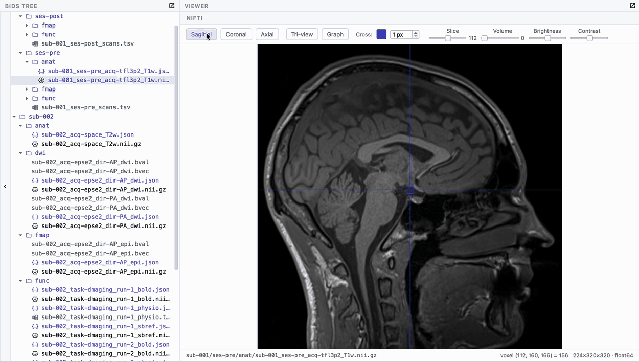 The NIfTI viewer: sagittal, coronal and axial sharing one crosshair