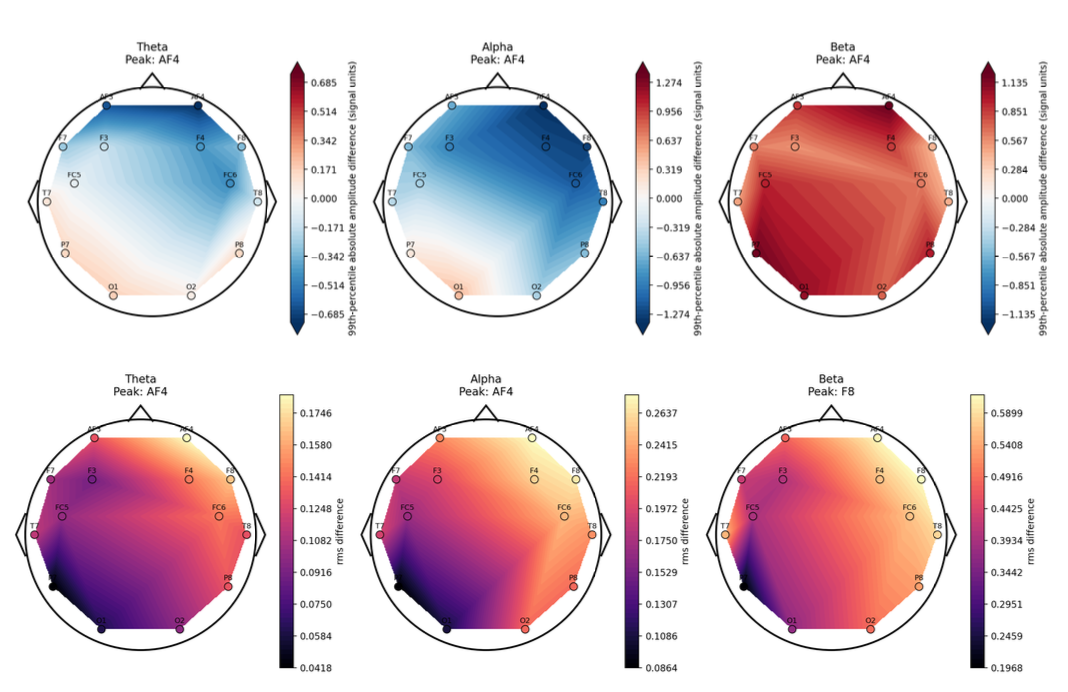 Counterfactual scalp topographies for theta, alpha, and beta bands, showing amplitude differences above and RMS differences below.