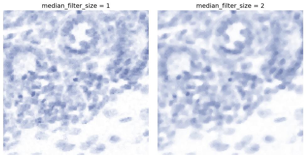 Median filter