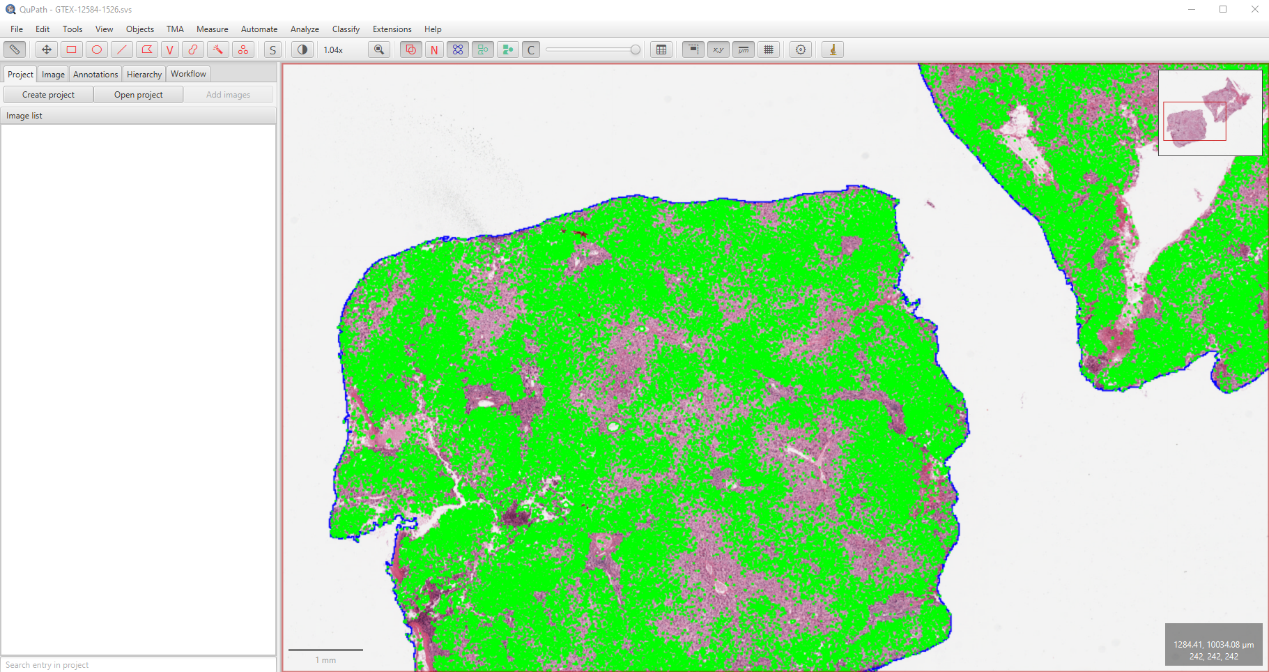 Visualise Fat globules in WSI using QuPath