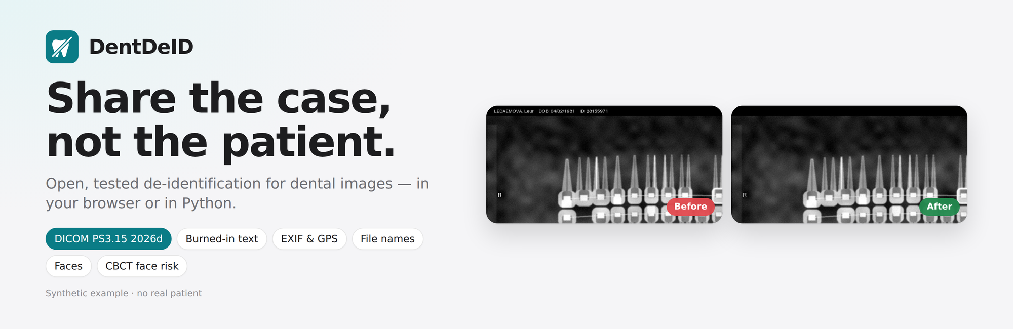 DentDeID — share the case, not the patient