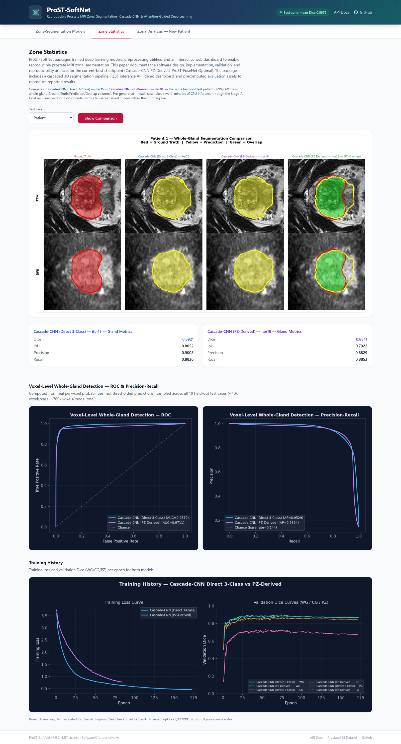 Zone Statistics tab: T2W and DWI overlays comparing ground truth against both models, per-model gland metrics, ROC and precision-recall curves, and training loss and validation Dice curves