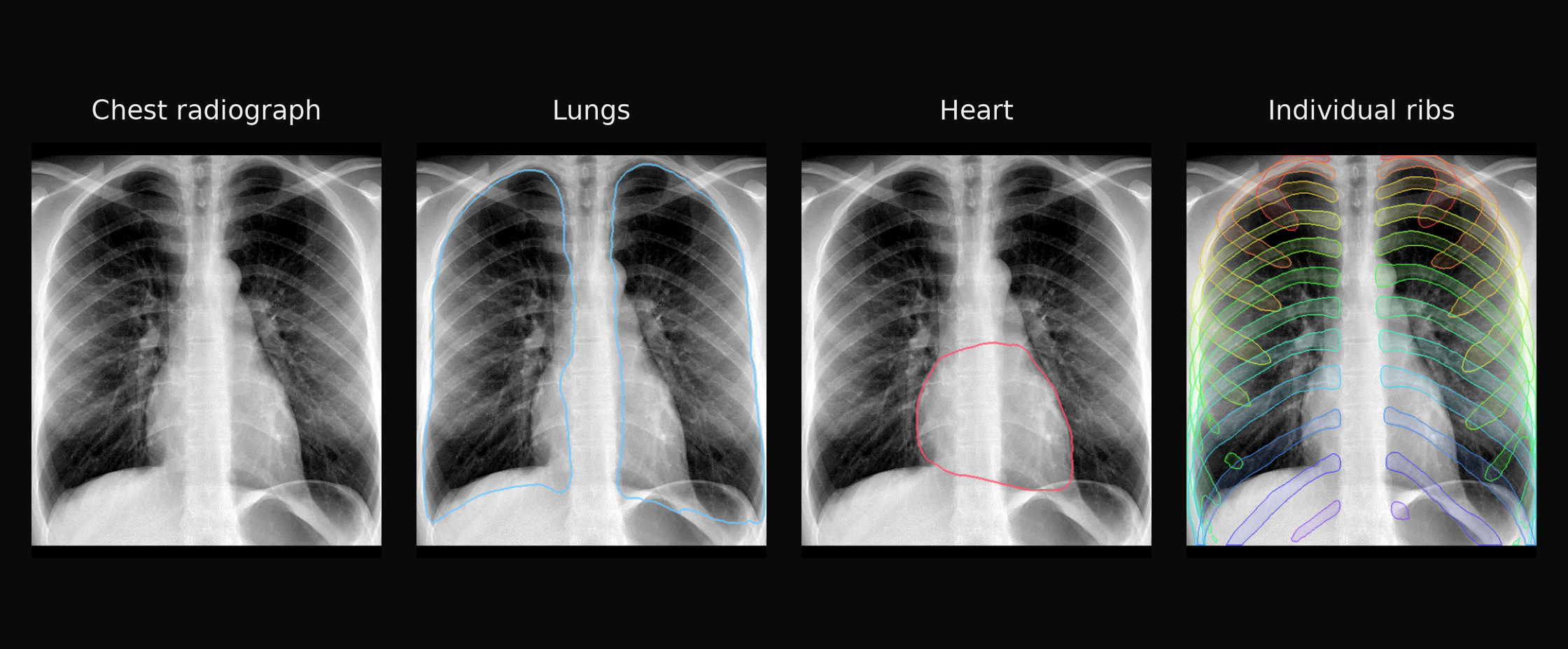 One chest radiograph → separate lung, heart and individual rib masks.