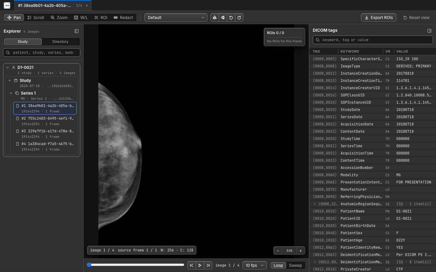 Mammography study in dcmview