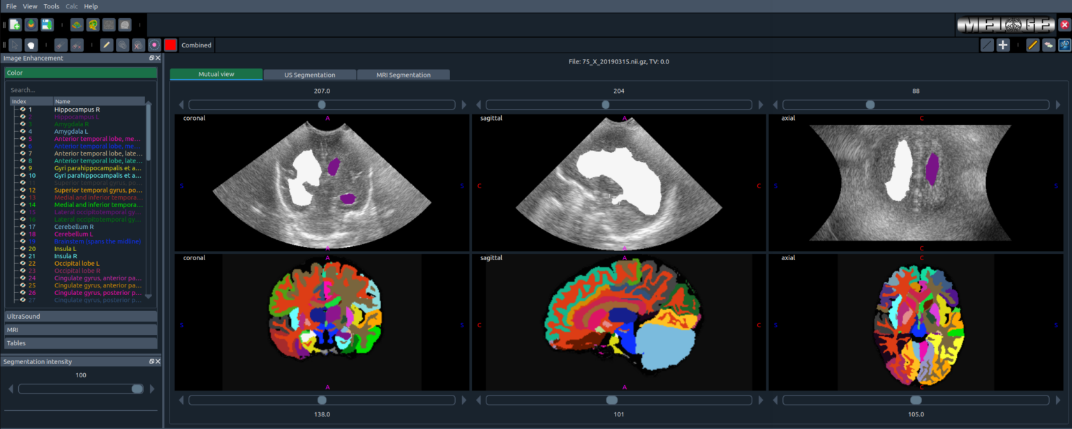 MELAGE GUI Screenshot