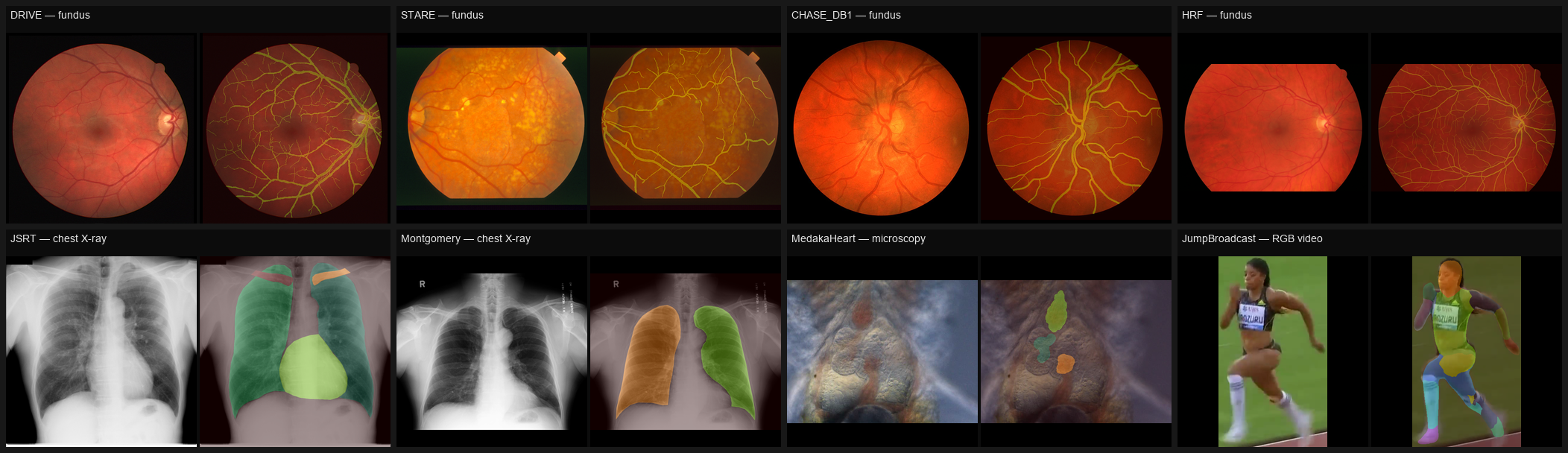 Example image / mask overlays per dataset