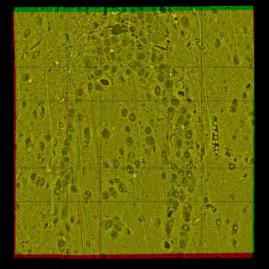 Aligned sections overlay