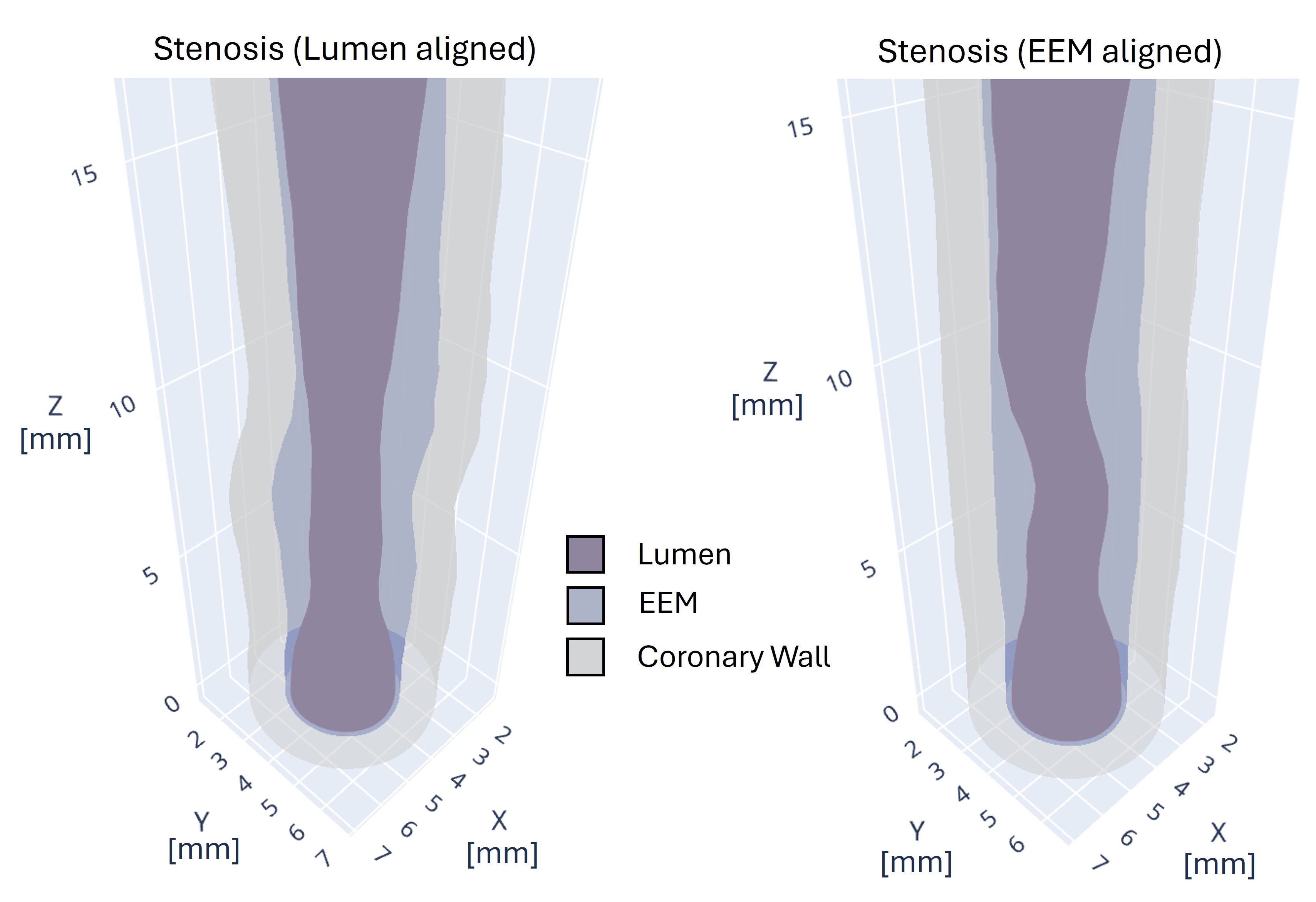 Coronary artery disease example