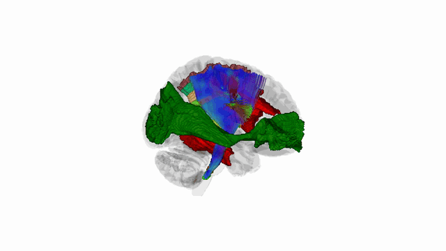 DiVE demo — 360° rotation of a bundle over a glass brain