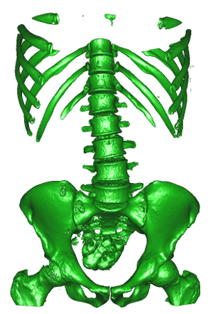 Surface mesh extracted from a large abdominal CT scan.
