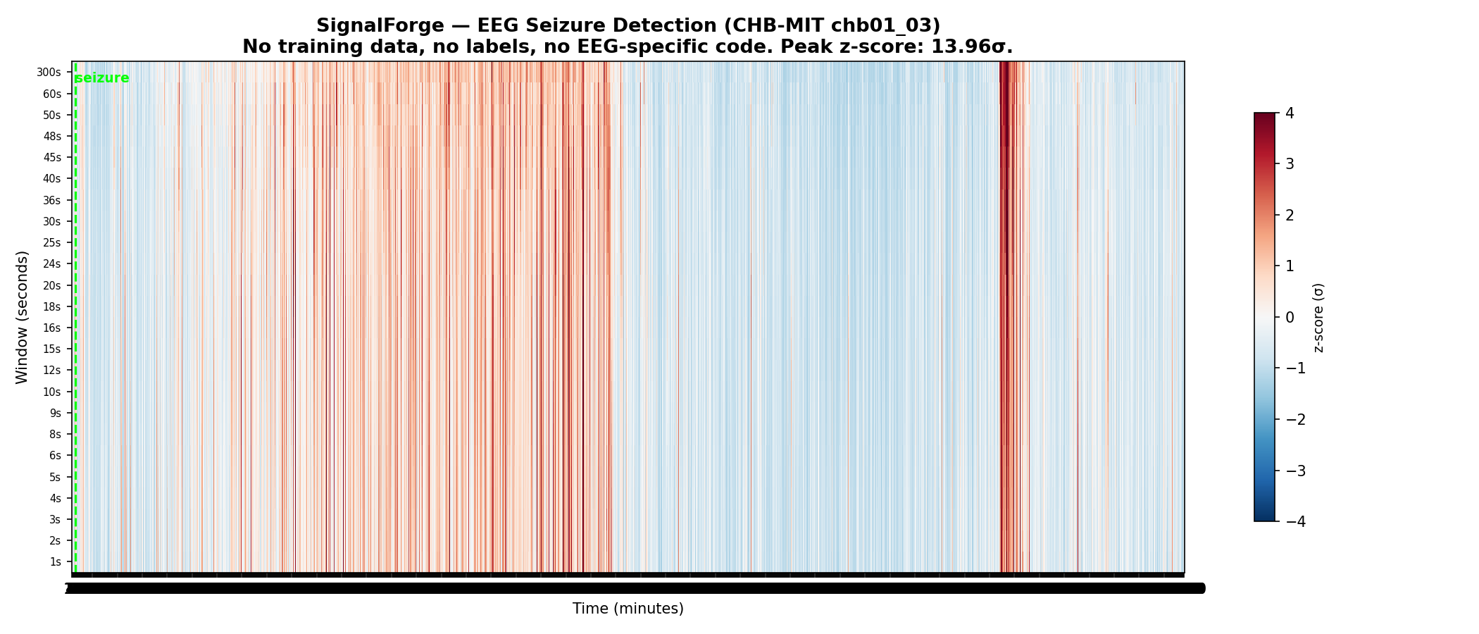 EEG seizure heatmap
