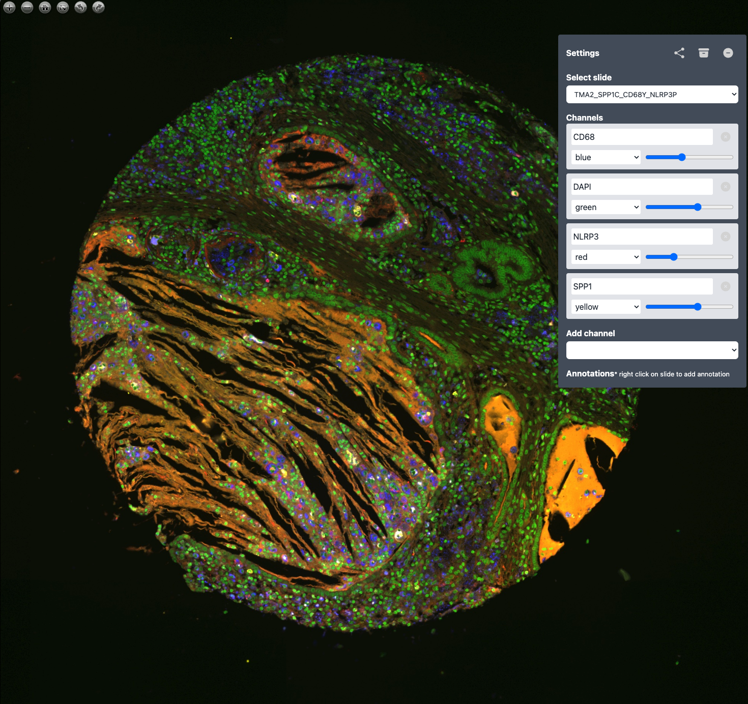 ImmunoViewer Screenshot
