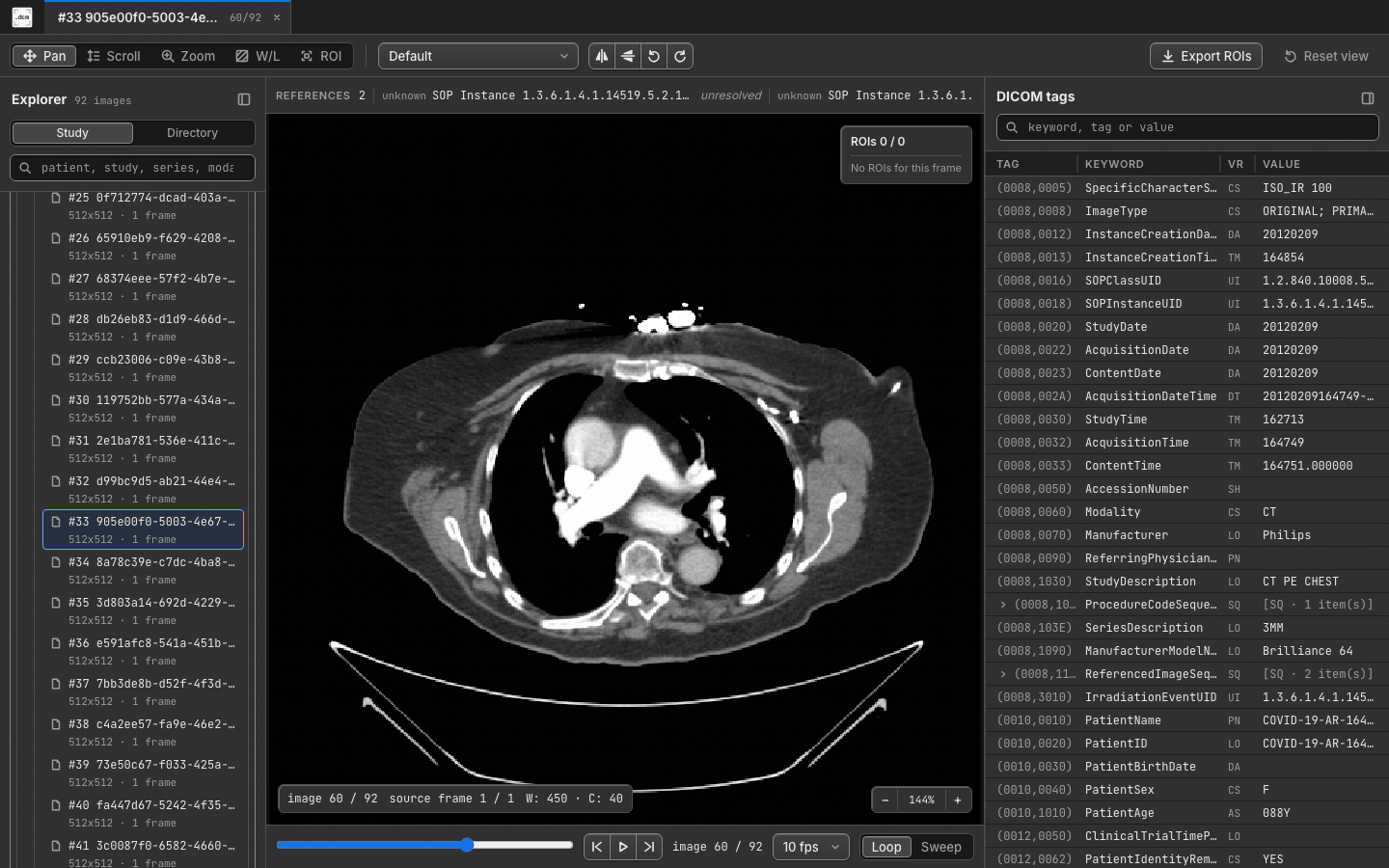 Chest CT cine playback in dcmview