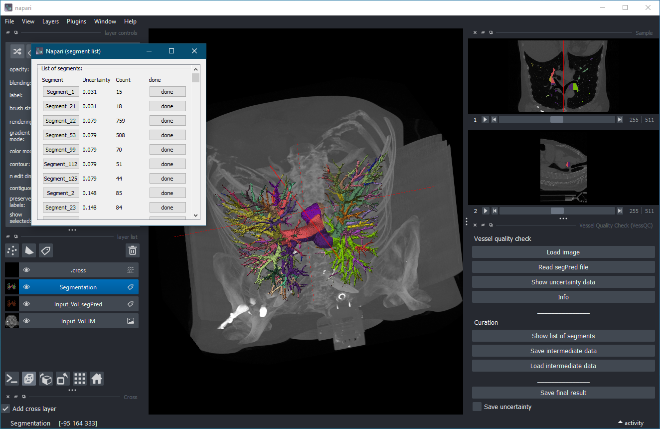 VessQC user interface
