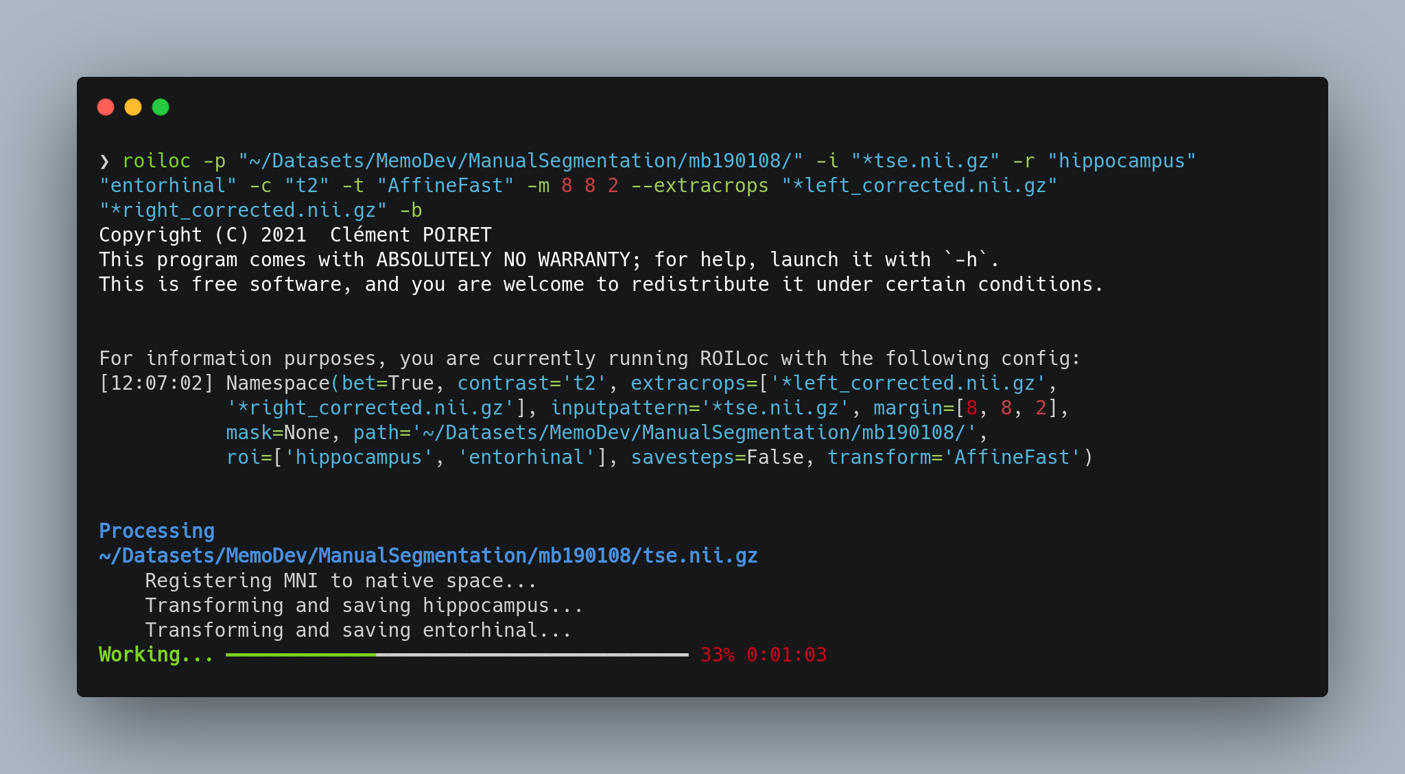 Example: using ROILoc for Hippocampus